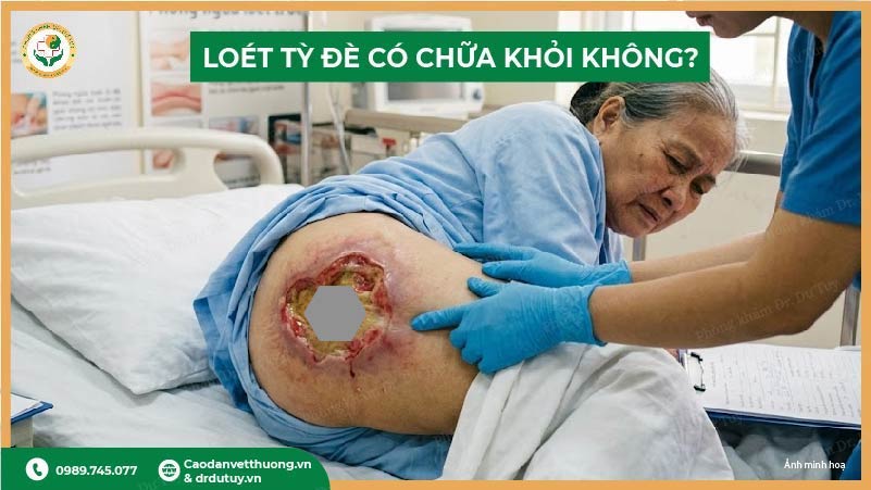 loét tỳ đè có chữa khỏi không giải đáp