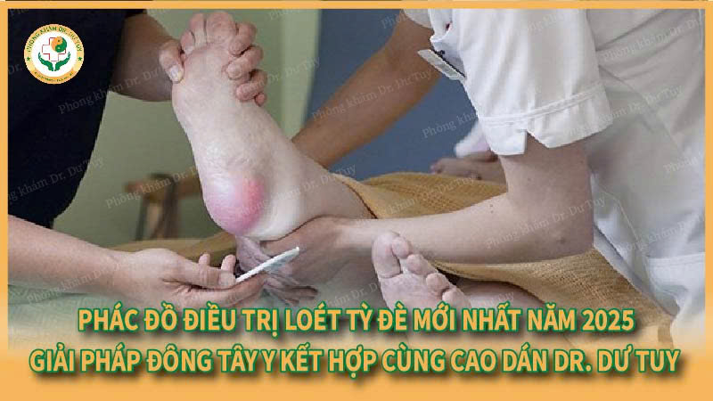 Phác đồ điều trị loét tỳ đè mới nhất năm 2025 – Giải pháp Đông Tây y kết hợp cùng Cao dán Dr. Dư Tuy