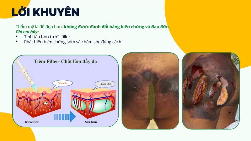 lời khuyên làm đẹp an toàn cho phụ nữ