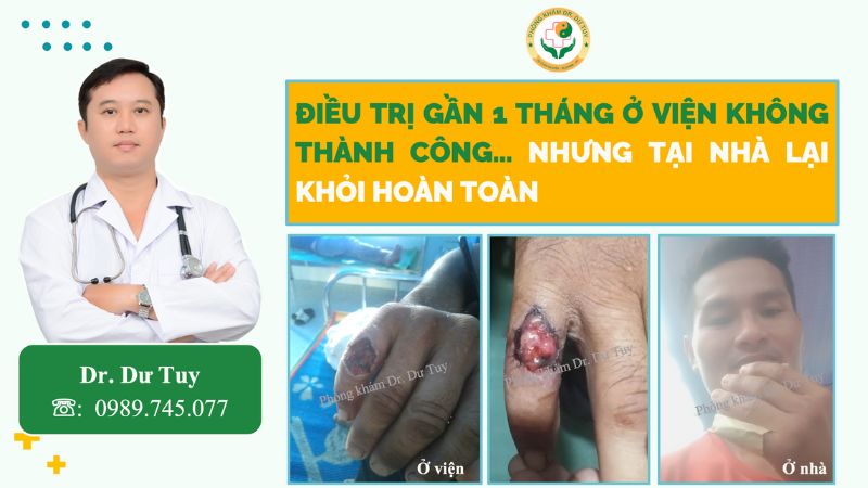 Điều trị ở viện gần 1 tháng không thành công, nhưng tại nhà lại khỏi hoàn toàn