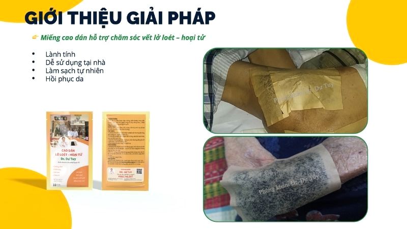 miếng cao dán hỗ trợ chăm sóc vết loét hoại tử