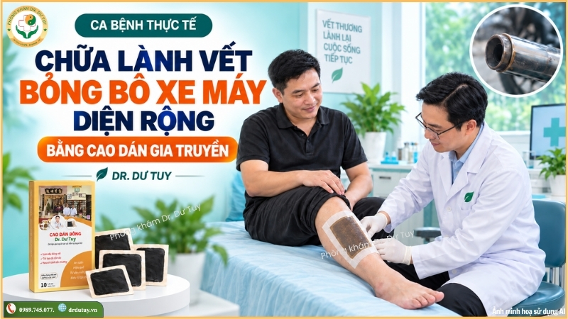 miếng dán trị bỏng