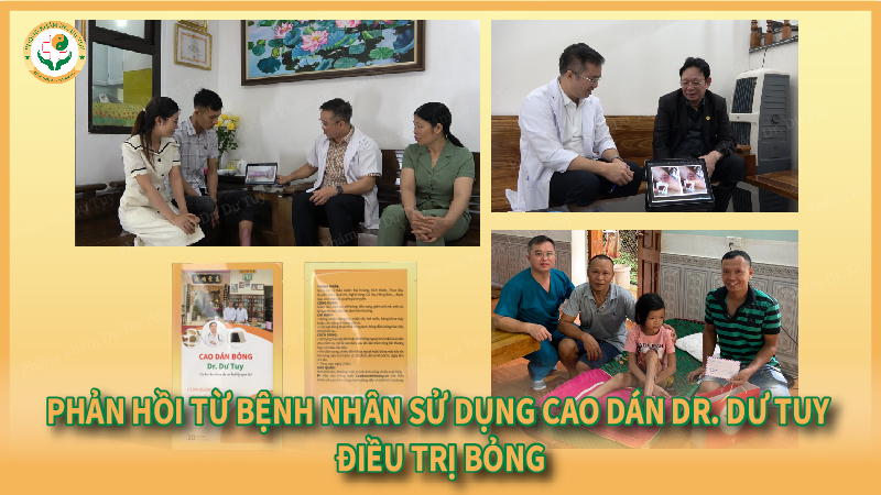 miếng dán trị bỏng ngoài da