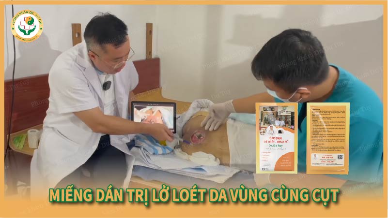 Miếng dán trị lở loét da vùng cùng cụt