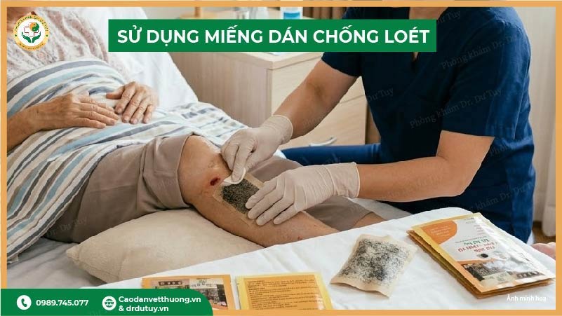 miếng dán trị loét da