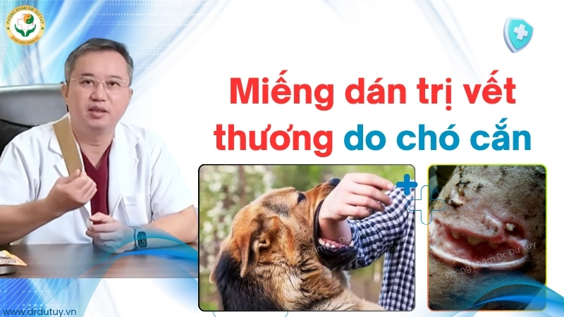 Điều trị vết thương do chó cắn không liền sau 17 ngày- Hồi phục ngoạn mục nhờ miếng dán