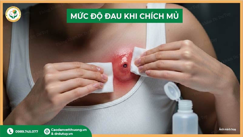 mức độ đau khi chích mủ áp xe