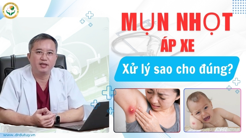 mụn nhọt áp xe xử lý đúng