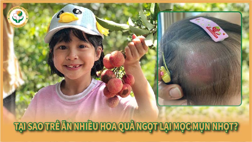 Tại sao trẻ ăn nhiều hoa quả ngọt lại mọc mụn nhọt