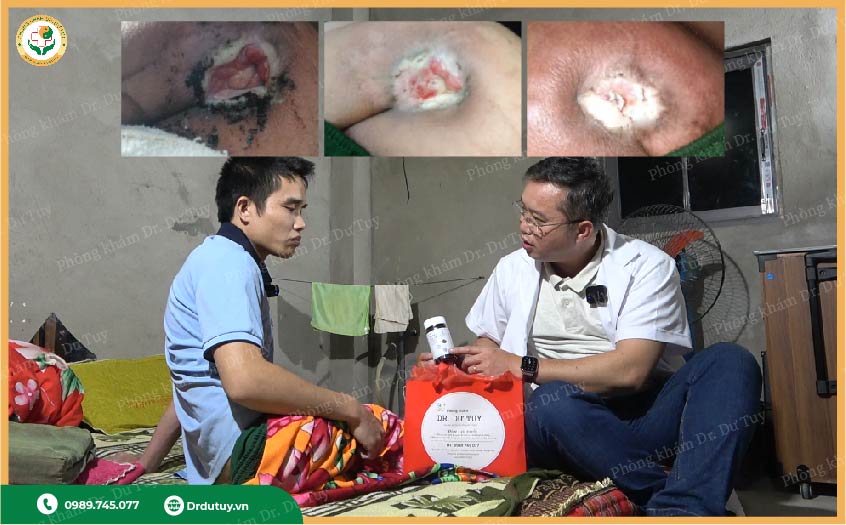 ngăn ngừa loét da