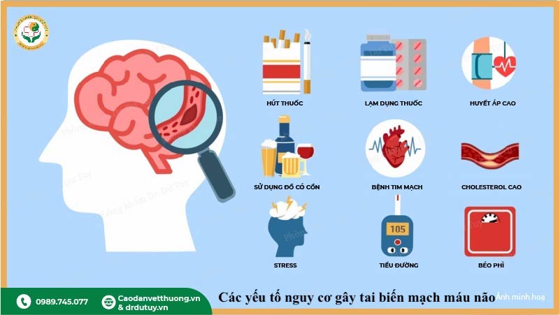 nguy cơ tai biến mạch máu não