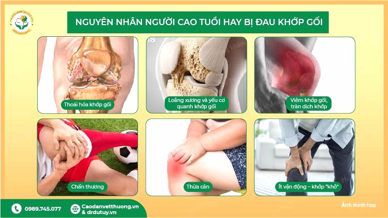 nguyên nhân đau khớp gối ở người cao tuổi