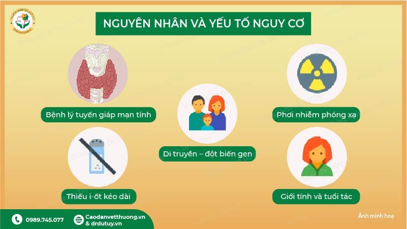nguyên nhân yếu tố nguy cơ ung thư tuyến giáp