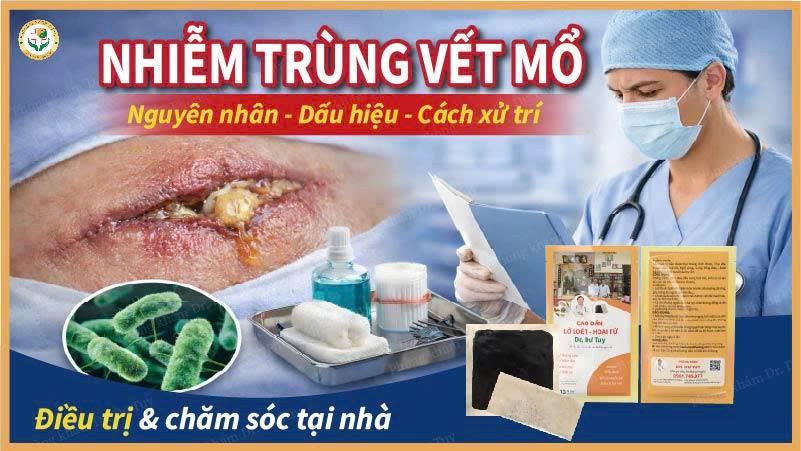 nhiễm trùng vết mổ