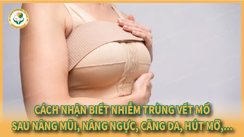 Cách nhận biết nhiễm trùng vết mổ sau nâng mũi, nâng ngực, căng da, hút mỡ...