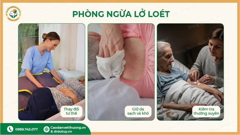 phòng ngừa lở loét ngoài da