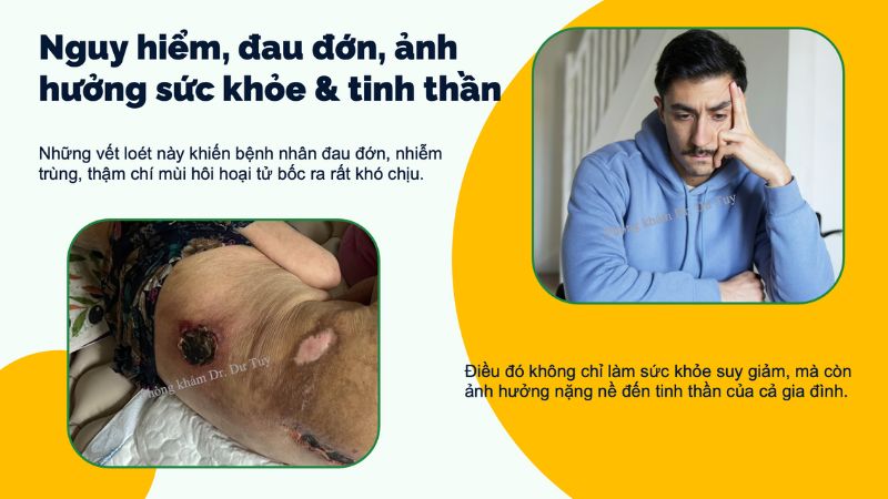 phòng ngừa loét do tỳ đè