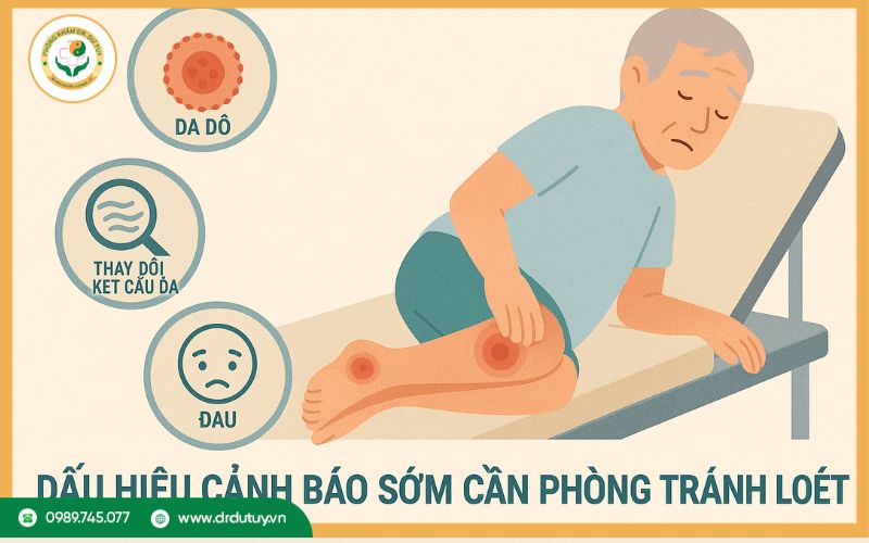 Dấu hiệu cảnh báo sớm cần phòng tránh loét