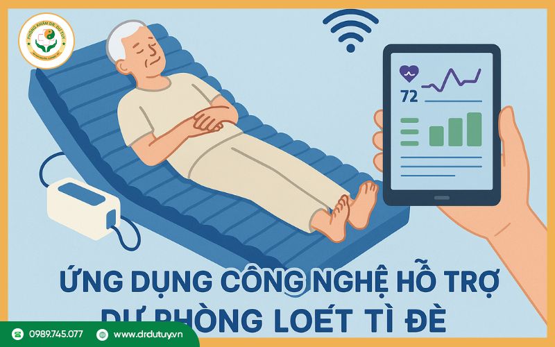 Ứng dụng công nghệ hỗ trợ dự phòng loét tì đè
