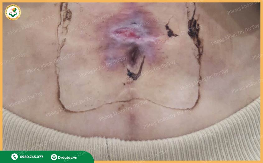 phục hồi da sau làm đẹp