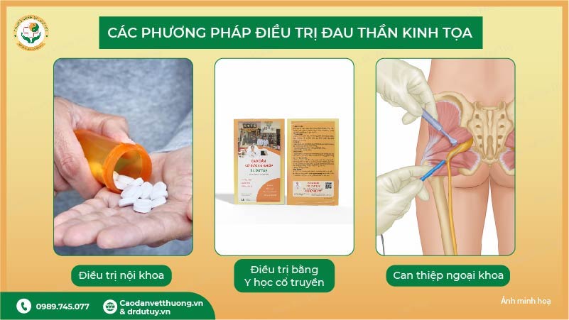 phương pháp điều trị đau thần kinh toạ nội khoa y học cổ truyền