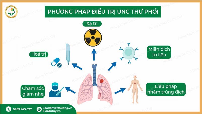 phương pháp điều trị ung thư phổi hoá trị xạ trị miễn dịch
