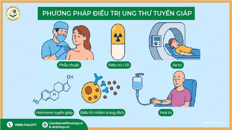 phương pháp điều trị ưng thư tuyến giáp phẫu thuật i 131