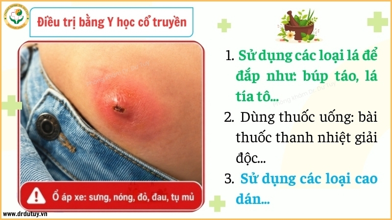 phuong pháp y học cổ truyền hỗ trợ áp xe