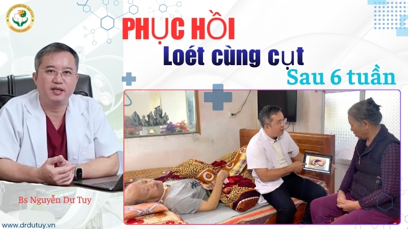 quá trình hồi phục loét tỳ đè sau tai biến