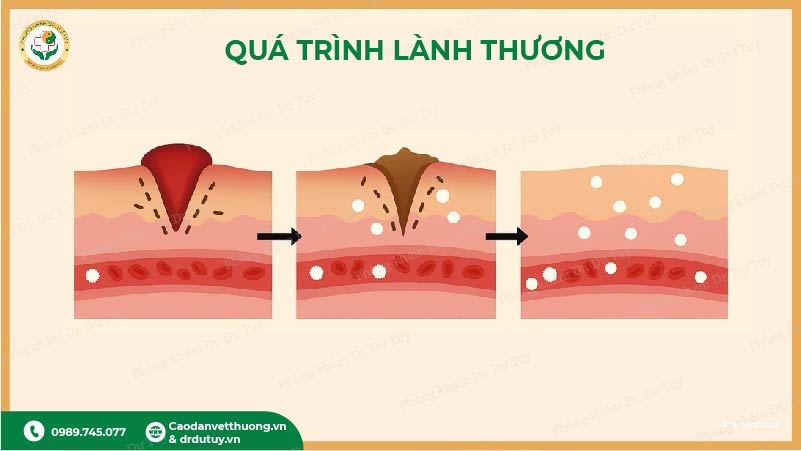 quá trình lành vết loét ngoài da
