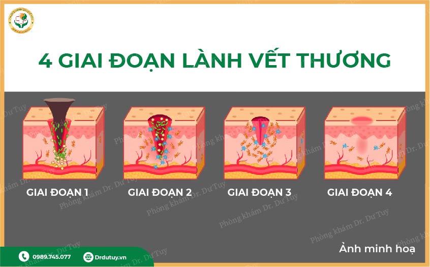 quá trình lành vết thương