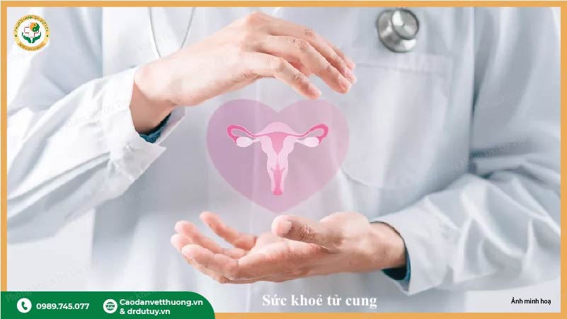 quản lý pcos lâu dài bảo vệ sức khoẻ sinh sản