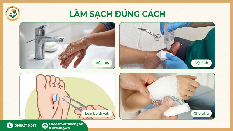 quy trình làm sạch vết thương ngoài da