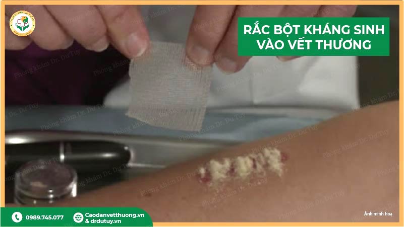 rắc bột kháng sinh lên vết thương