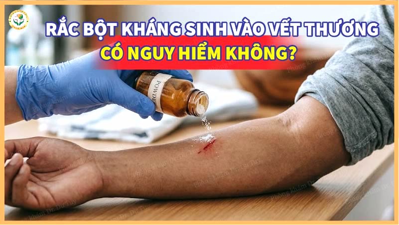 rắc bột kháng sinh vào vết thương có nguy hiểm không?