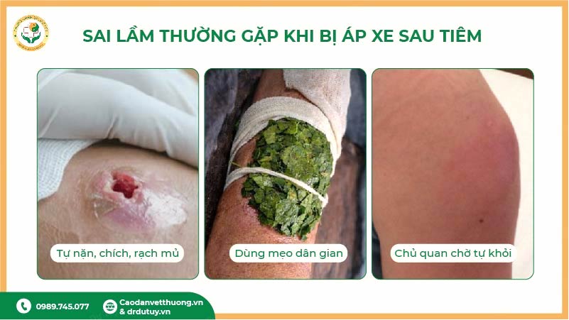 sai lầm khi bị áp xe sau tiêm