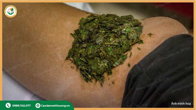 sai lầm khi xử lý vết thương