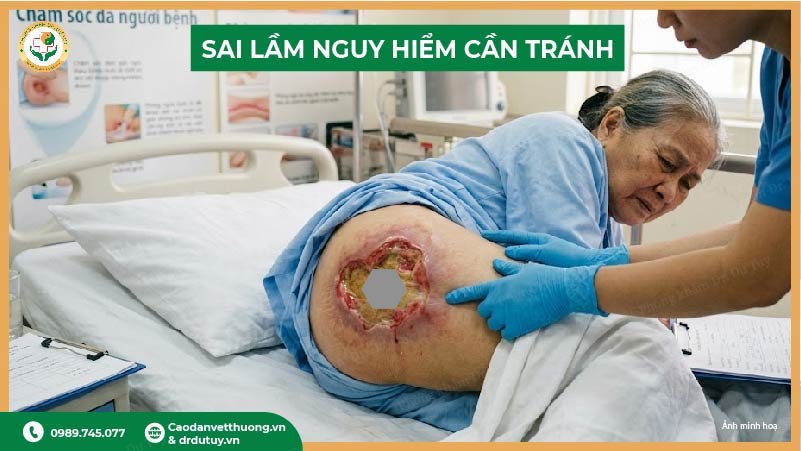 sai lầm nguy hiểm khi để loét tự khỏi