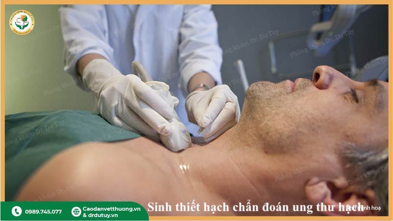 sinh thiết hạch chẩn đoán ung thư hạch