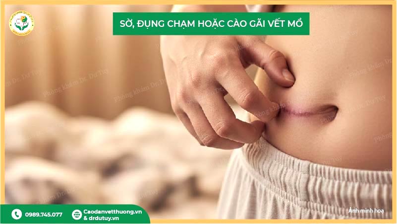 sờ cào gãi vết mổ khiến vết thương chậm lành