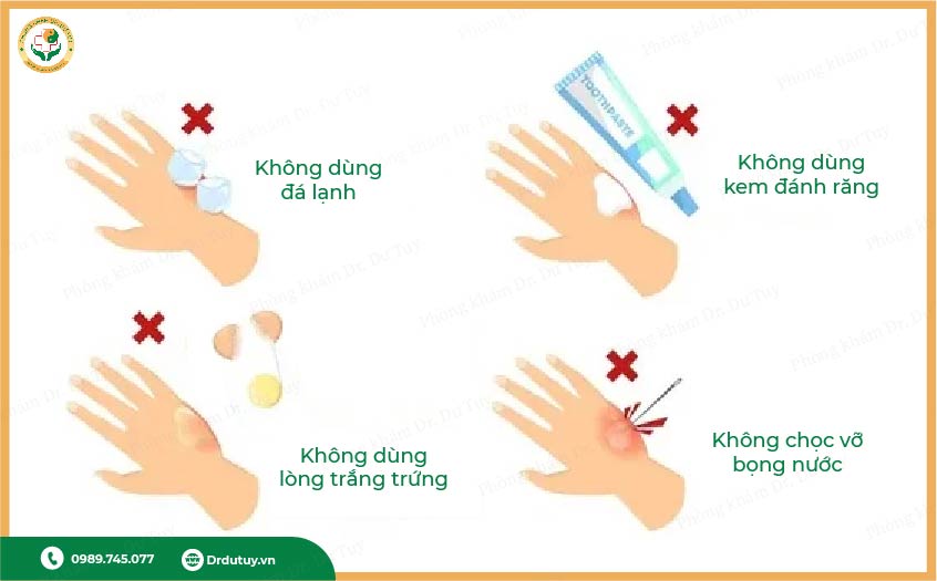 sơ cứu bỏng bô xe máy