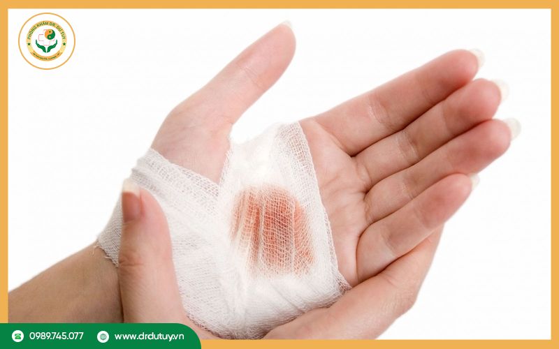 Những sai lầm thường gặp khi sơ cứu vết thương