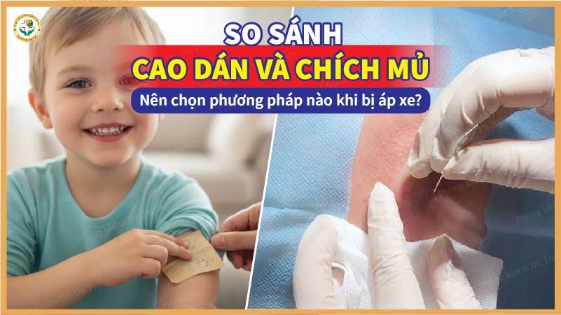 So sánh cao dán và chích mủ: Nên chọn phương pháp nào khi bị áp xe?