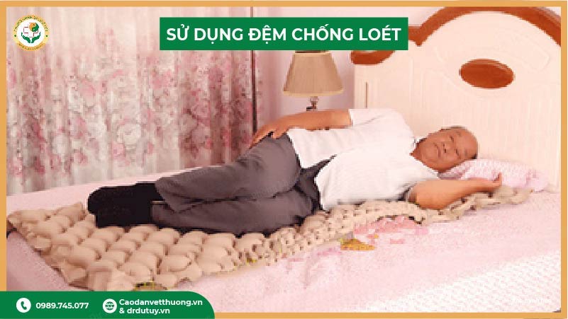 sử dụng đệm chống loét cho người nằm lâu