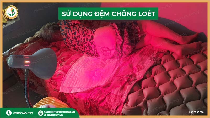 sử dụng đệm chống loét vùng cùng cụt