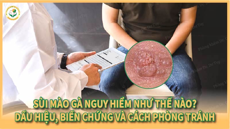 Sùi mào gà nguy hiểm như thế nào? Dấu hiệu, biến chứng và cách phòng tránh