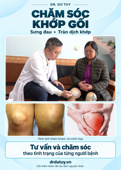 Sưng đau tràn dịch khớp