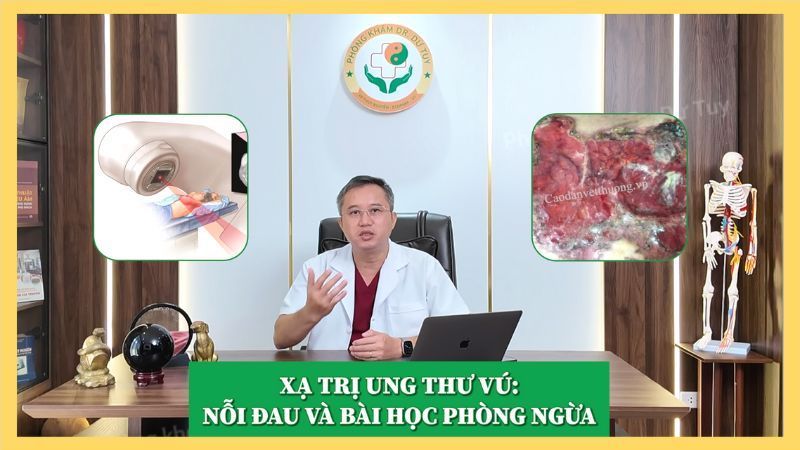 Xạ trị ung thư vú: Tác dụng phụ trên da và cách chăm sóc an toàn