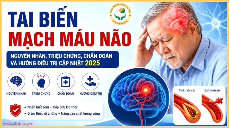 tai biến mạch máu não nguyên nhân, triệu chứng, chẩn đoán, điều trị 2025 Dr. Dư Tuy