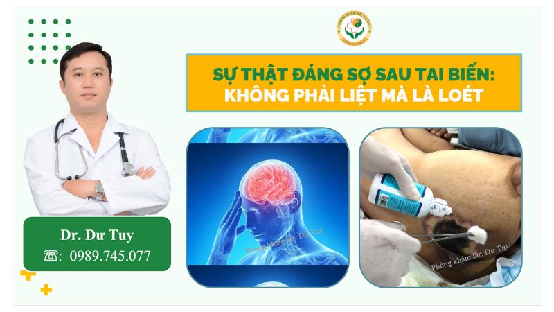 Sự thật đáng sợ sau tai biến: Không phải liệt mà là loét!